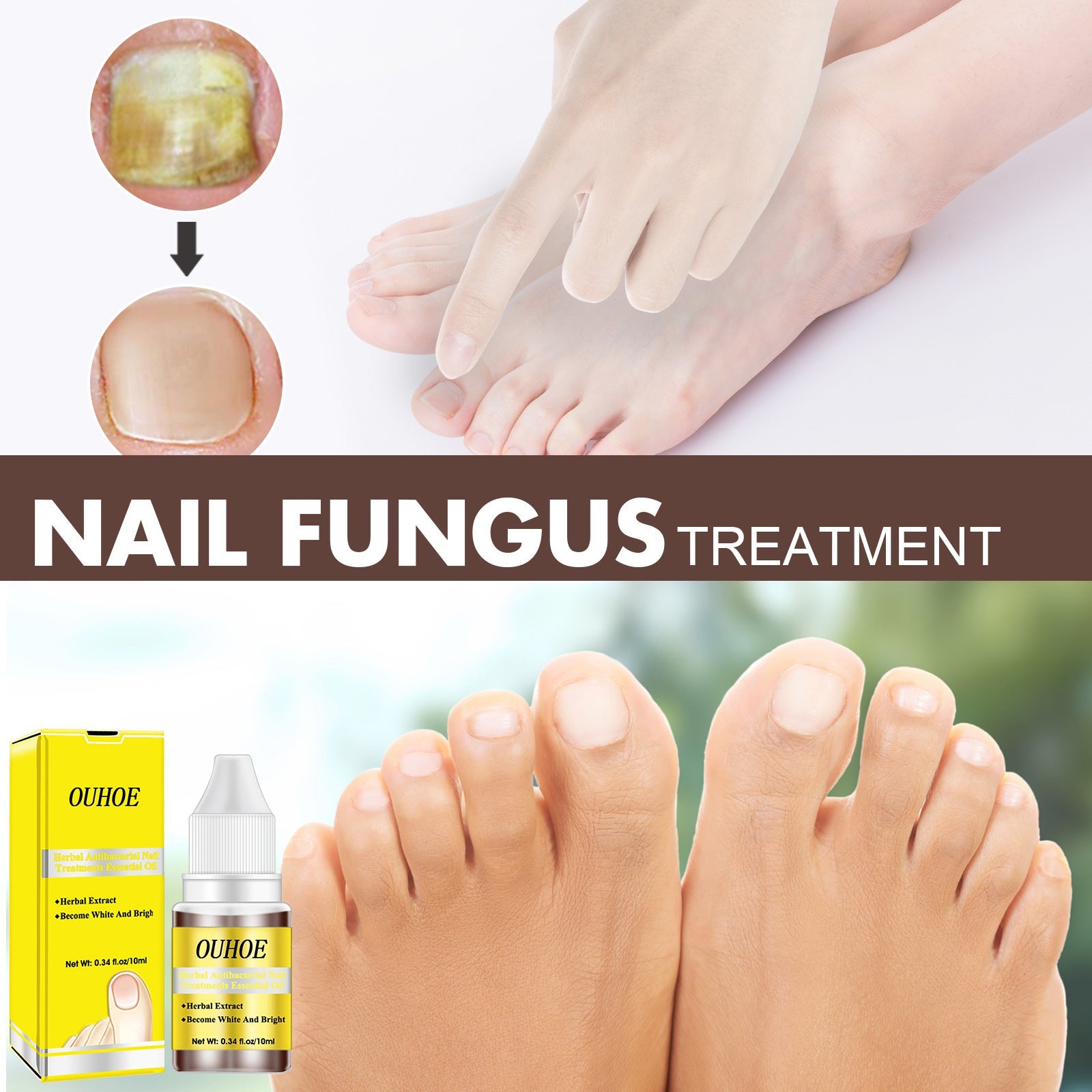Herbal Antibacterial Nail Treatments Essential Oil, Grey Nail Care Essential Oil Brightening Nail Polish Clean Manicure Foot Care Solution - Korvel