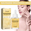 HOYGI Niacinamide Brightening Serum, Lightening Spots And Fine Lines Brightening Skin Hydrating Moisturizing Facial Treatment - Korvel