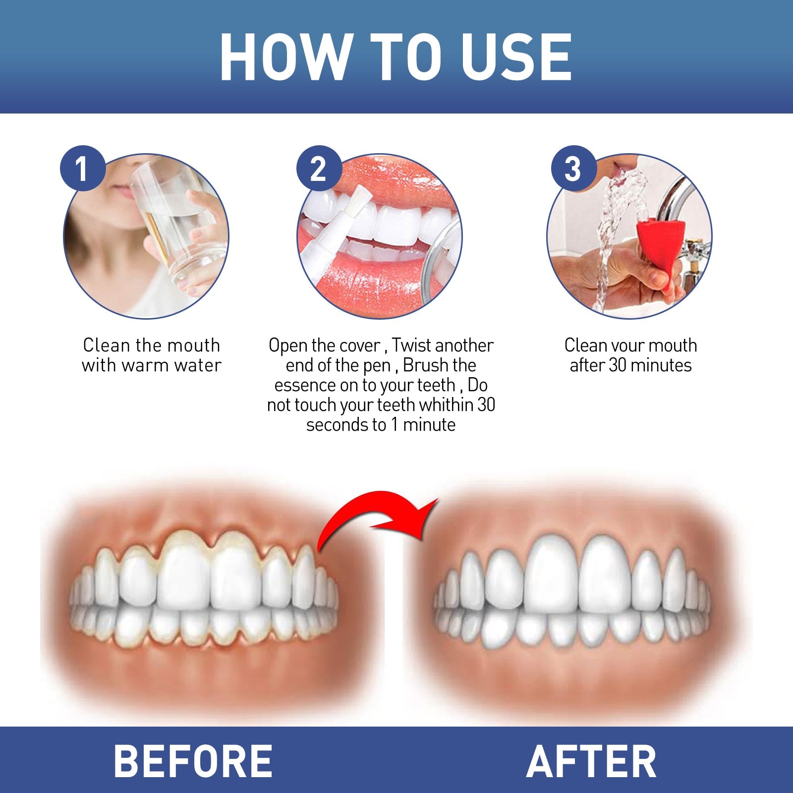 WestMonth Gum Instant Soothing Gel, Relieve Gums Swelling And Pain Clean Teeth Plaque Stains And Whiten Teeth Gel - Korvel