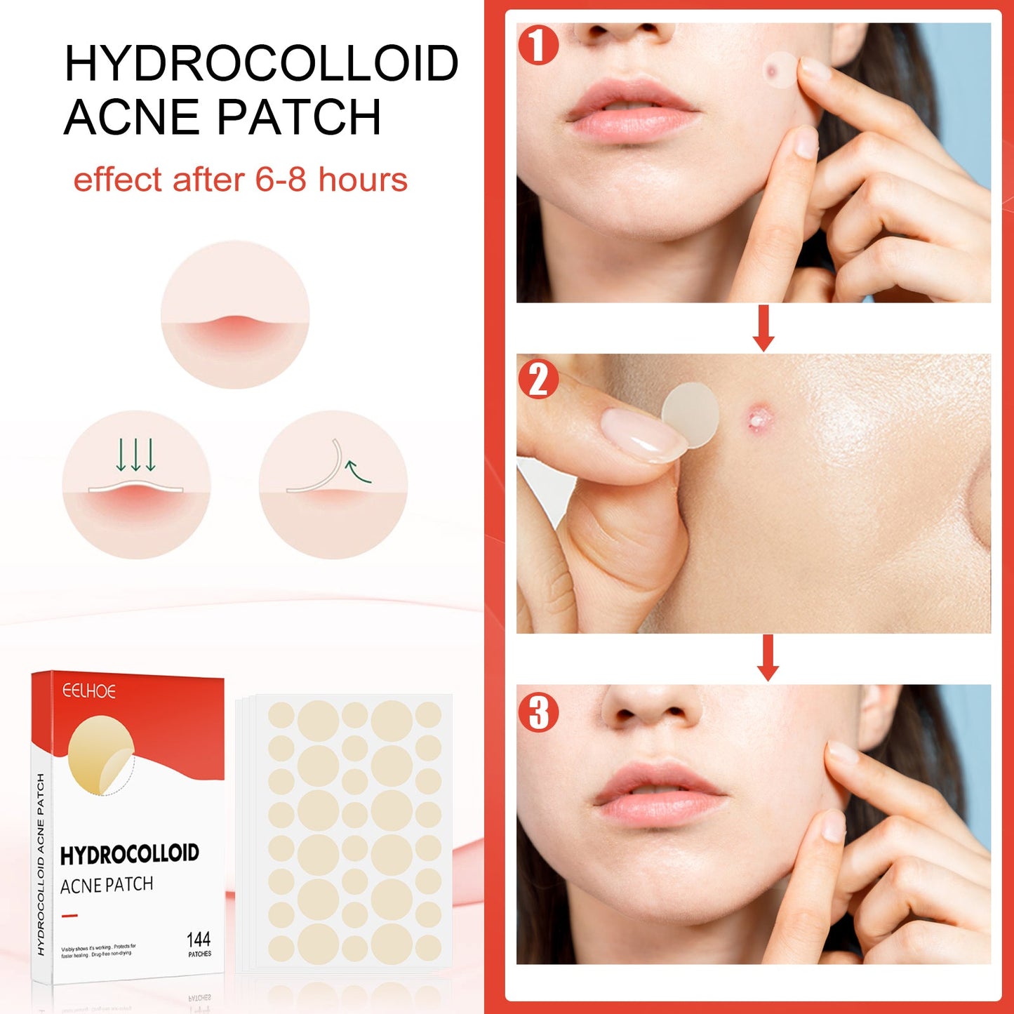 Invisible Hydrocolloid Acne Patches for Clear Skin