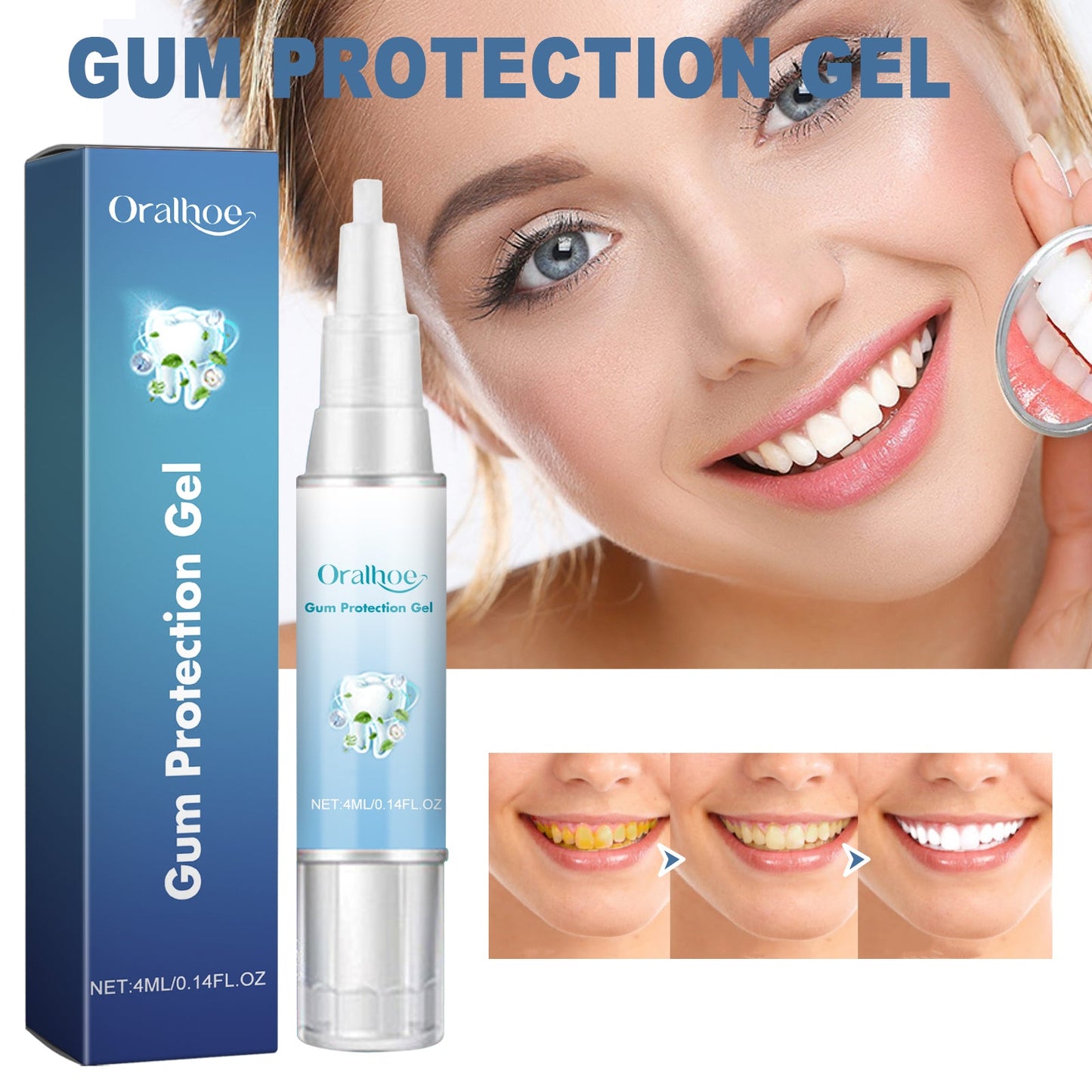 Gum Protection Gel, Teeth Whitening And Whitening Gum Repair Oral Cleaning And Care Dental Pencil - Korvel