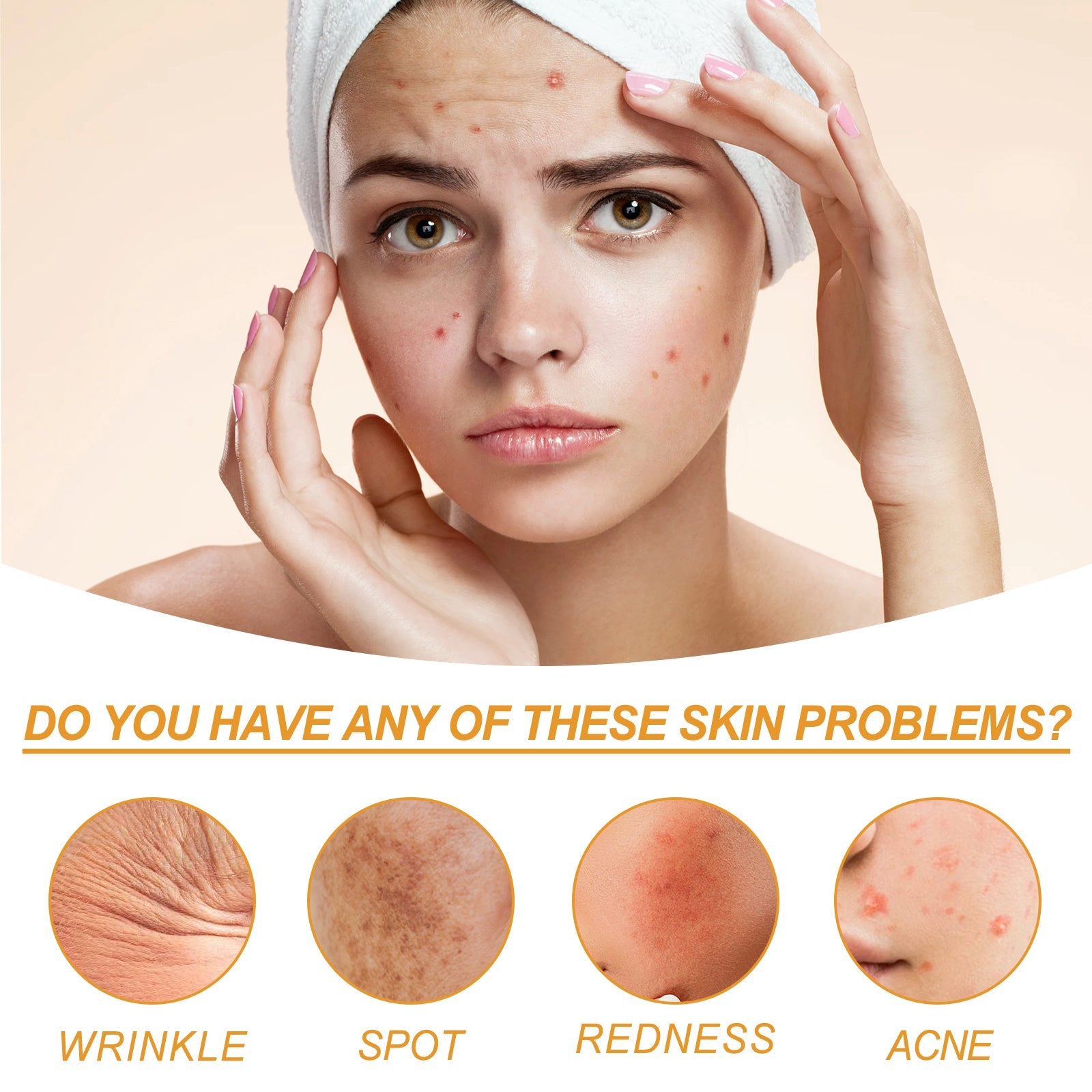 Facial Treatment Essence, Lighten Facial Acne Mark Oil Control Firming Skin Essence - Korvel
