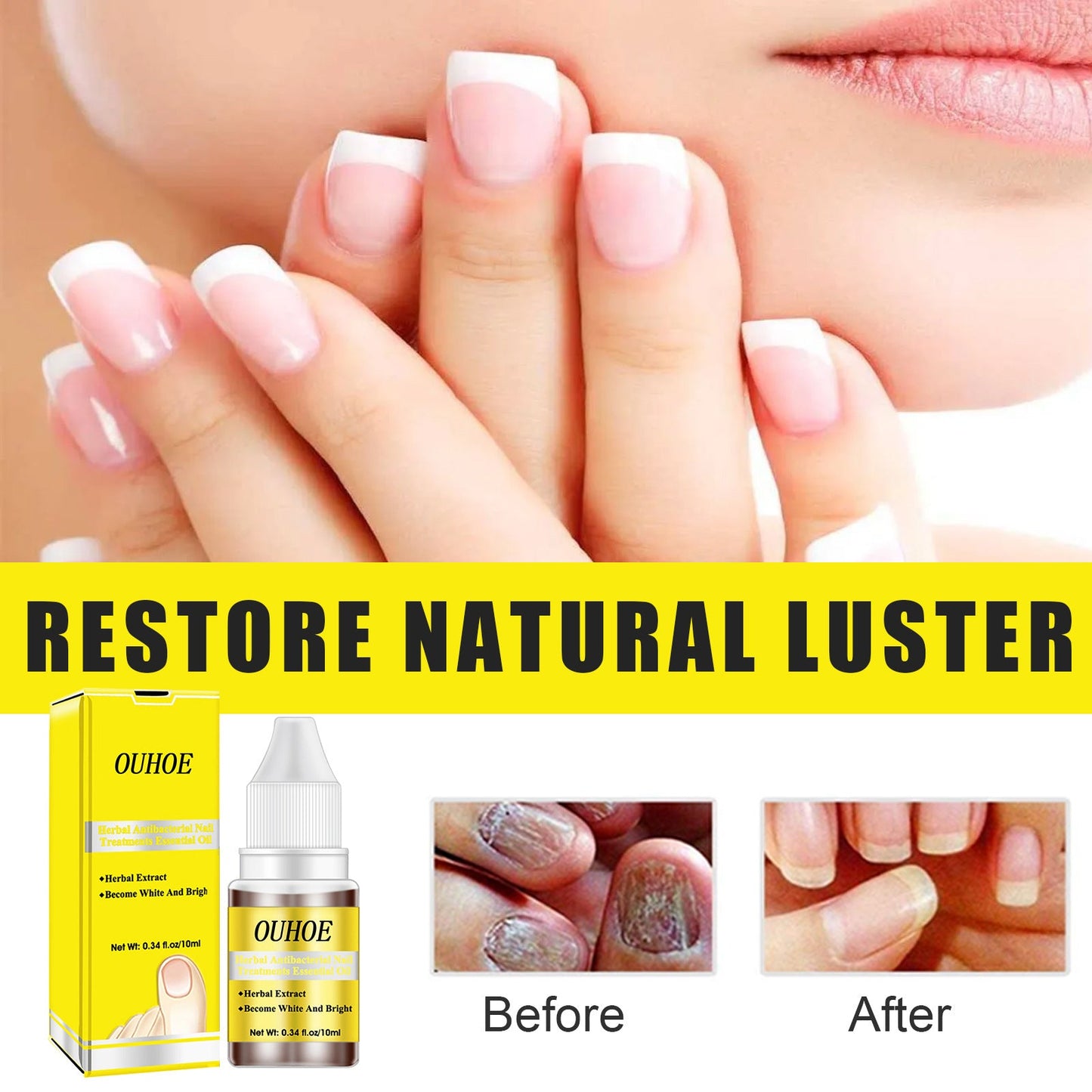Herbal Antibacterial Nail Treatments Essential Oil, Grey Nail Care Essential Oil Brightening Nail Polish Clean Manicure Foot Care Solution - Korvel