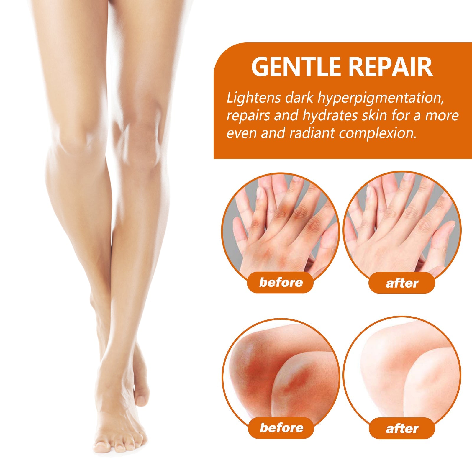 Acanthosis Nigricans Repair Essence, Brightening Skin Repair Skin Beauty Essence Underarm Joint Black Whitening - Korvel