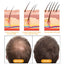 Ginger Juice Moisturizes Hair, Moisturizing And Repairing Hair Follicle Hair Strong Anti-Shampoos - Korvel