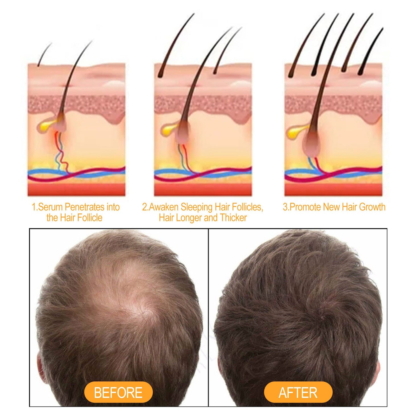 Ginger Juice Moisturizes Hair, Moisturizing And Repairing Hair Follicle Hair Strong Anti-Shampoos - Korvel