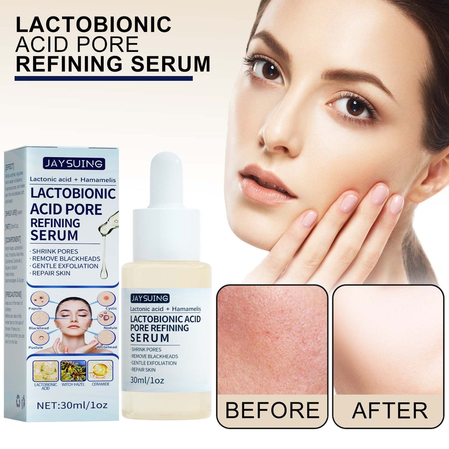 Lactose Solution, Exfoliate Remove Blackheads Shrink Pores Clean And Moisturize SkinEssence - Korvel