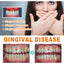Tooth Repair Essence, Cleaning Teeth Stains Tartar Care Gums Oral Care Essence - Korvel