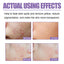 Lavender Oil Control Acne-Cleansing Soap For Cleansing Facial Skin Pores Oil Control Acne-Moisturizing Cleansing Soap - Korvel