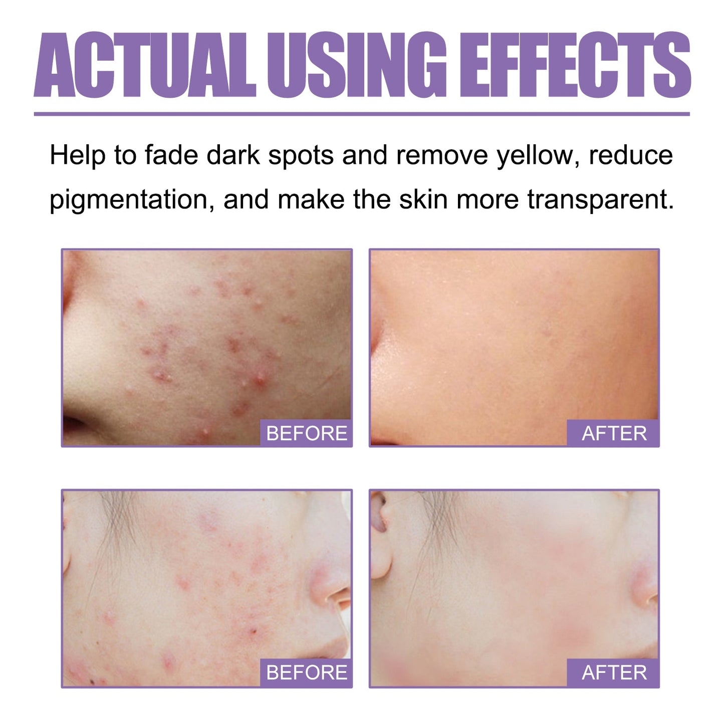 Lavender Oil Control Acne-Cleansing Soap For Cleansing Facial Skin Pores Oil Control Acne-Moisturizing Cleansing Soap - Korvel
