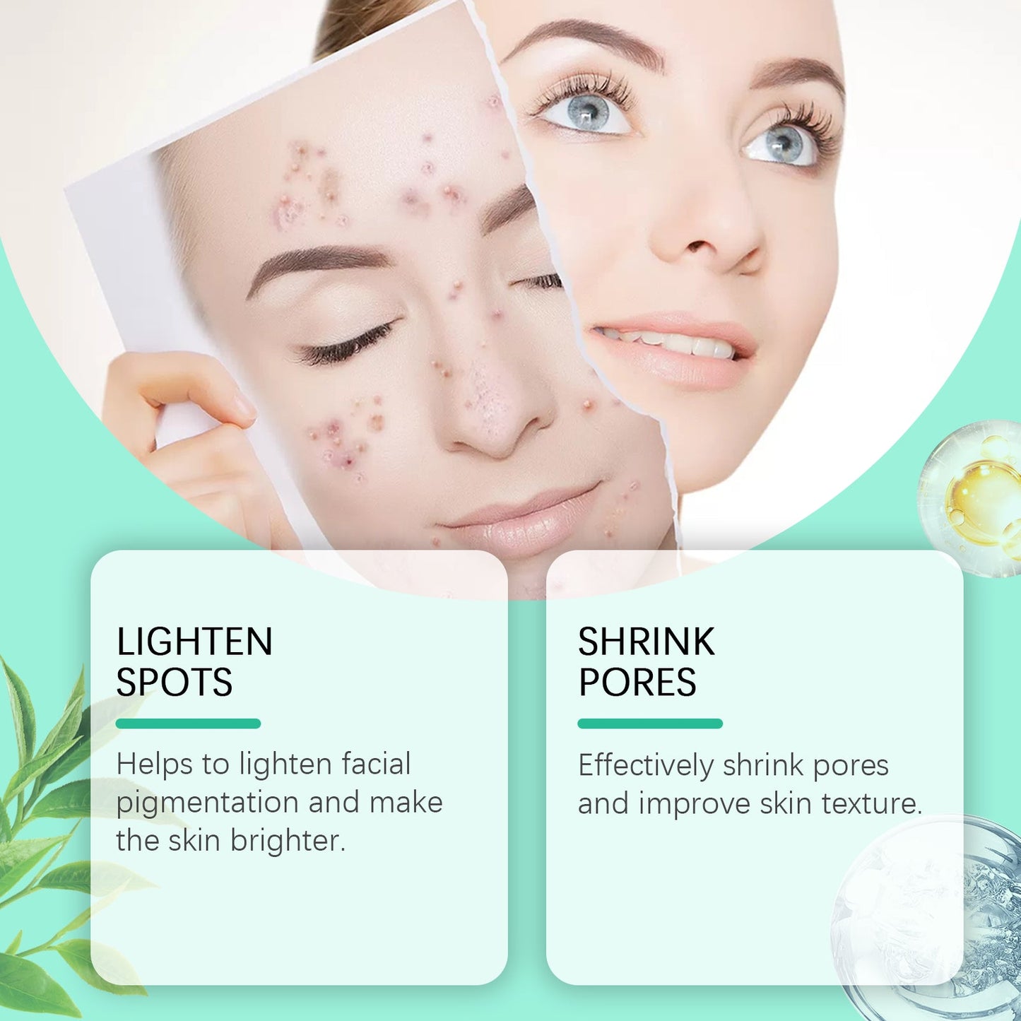 Salicylic Acid Care Patch Oil Control Refreshing Gentle Clean Care Skin Hydrating Moisturizing Cleanser - Korvel