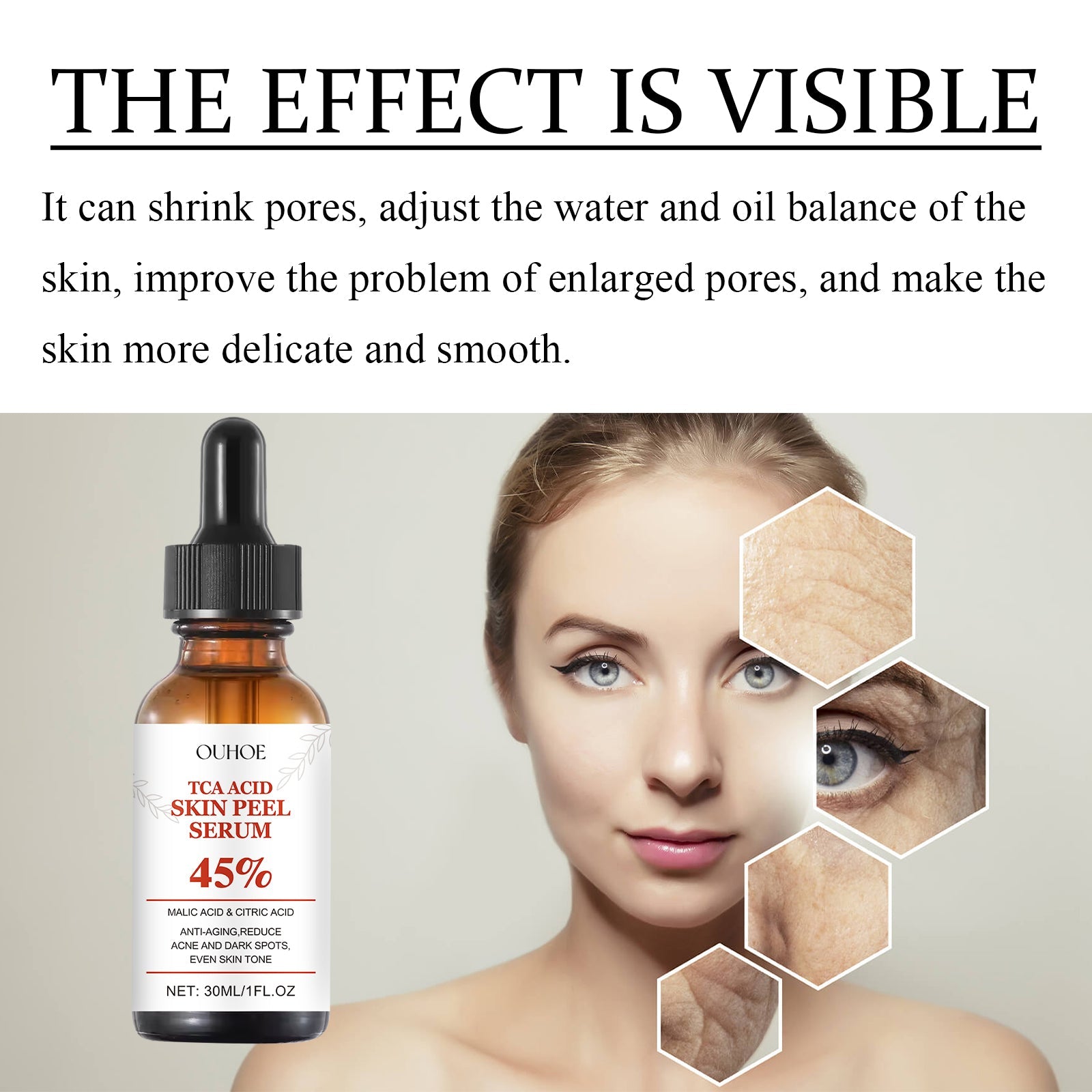 TCA Acid Skin Peel Serum - Korvel