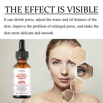 TCA Acid Skin Peel Serum - Korvel