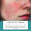 Hair Follicle Care Cream Care Scalp Back Face Clean Repair Acne Hair Follicle Care Cream - Korvel