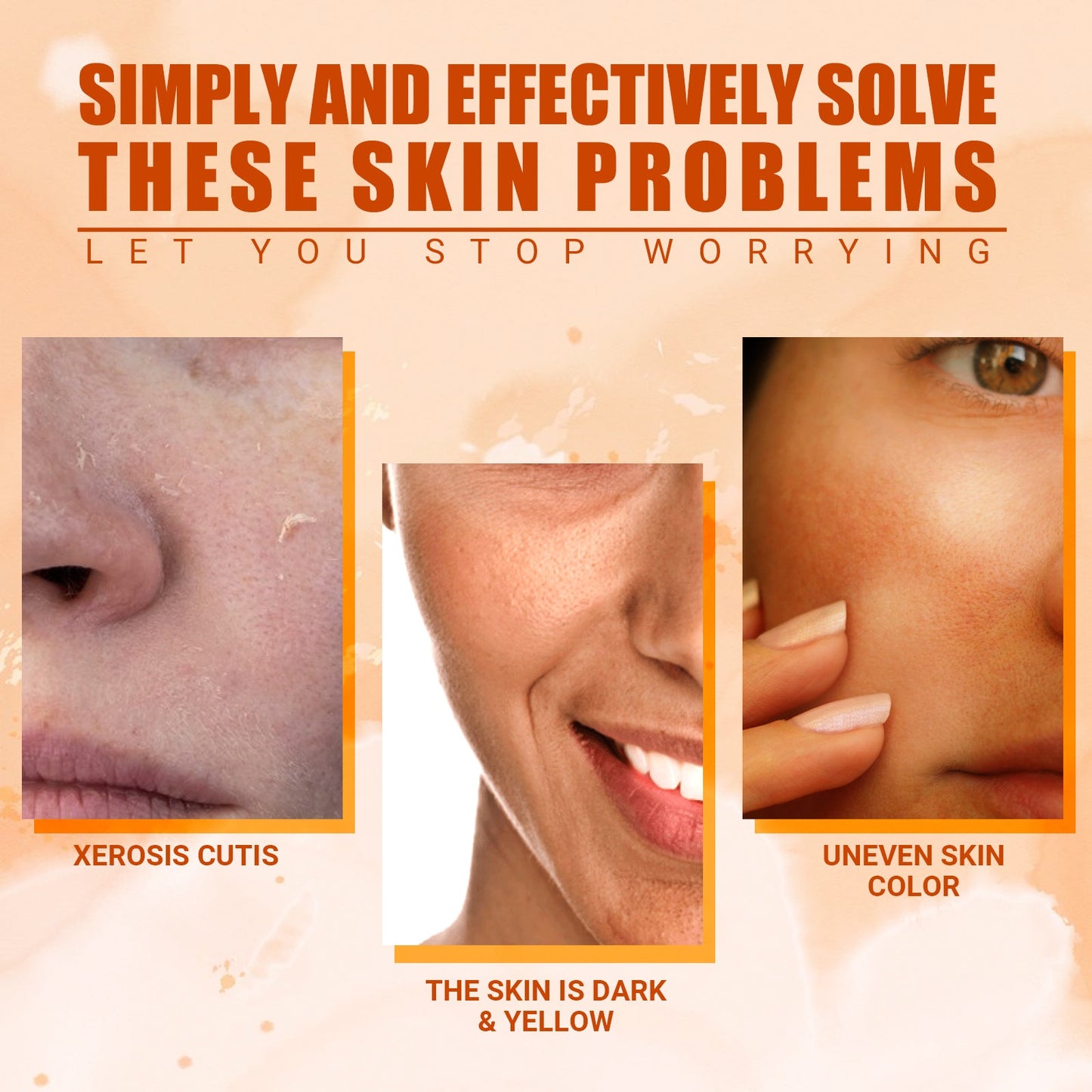 Vitamin C Moisturizing Spray Hydrates And Moisturizes Skin, Lightening Acne Spots And Whitening Spray - Korvel