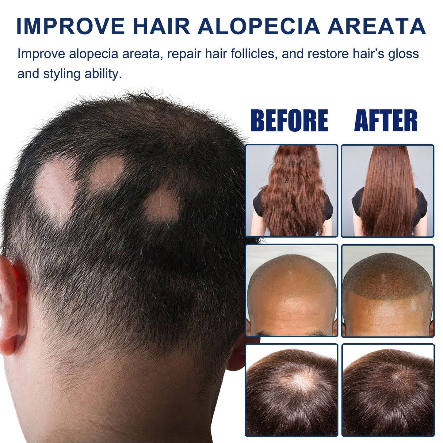 Alopecia Areata Care Set, Clean Scalp Supple Care Frizzy Hair Wash And Care Gift Set - Korvel