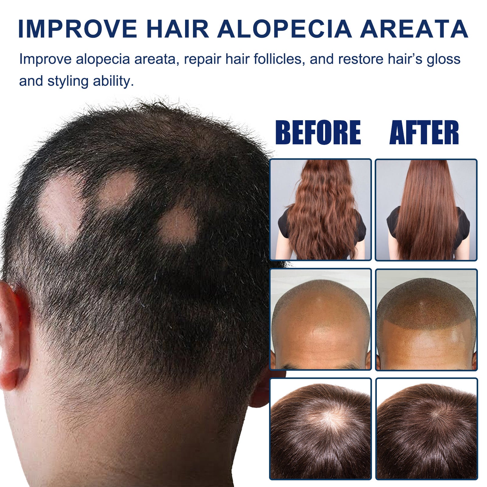 Alopecia Areata Care Set, Clean Scalp Supple Care Frizzy Hair Wash And Care Gift Set - Korvel