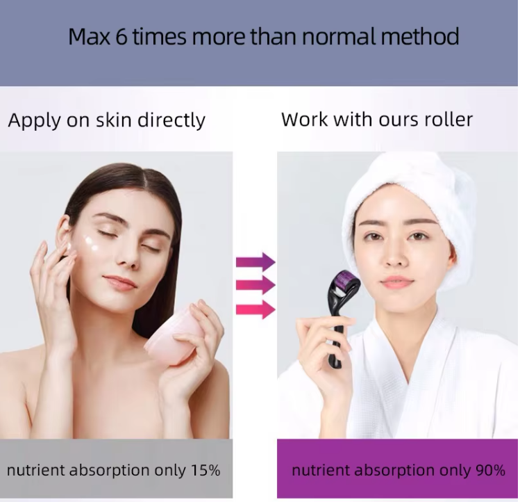 Premium 540 Micro Needle Derma Roller for Skin Care