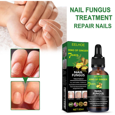 Nail Care Liquid Hand and Foot Nail Care Liquid Daily Cleaning Nail Brightness Soft Nail Moisturizing Nail - Korvel