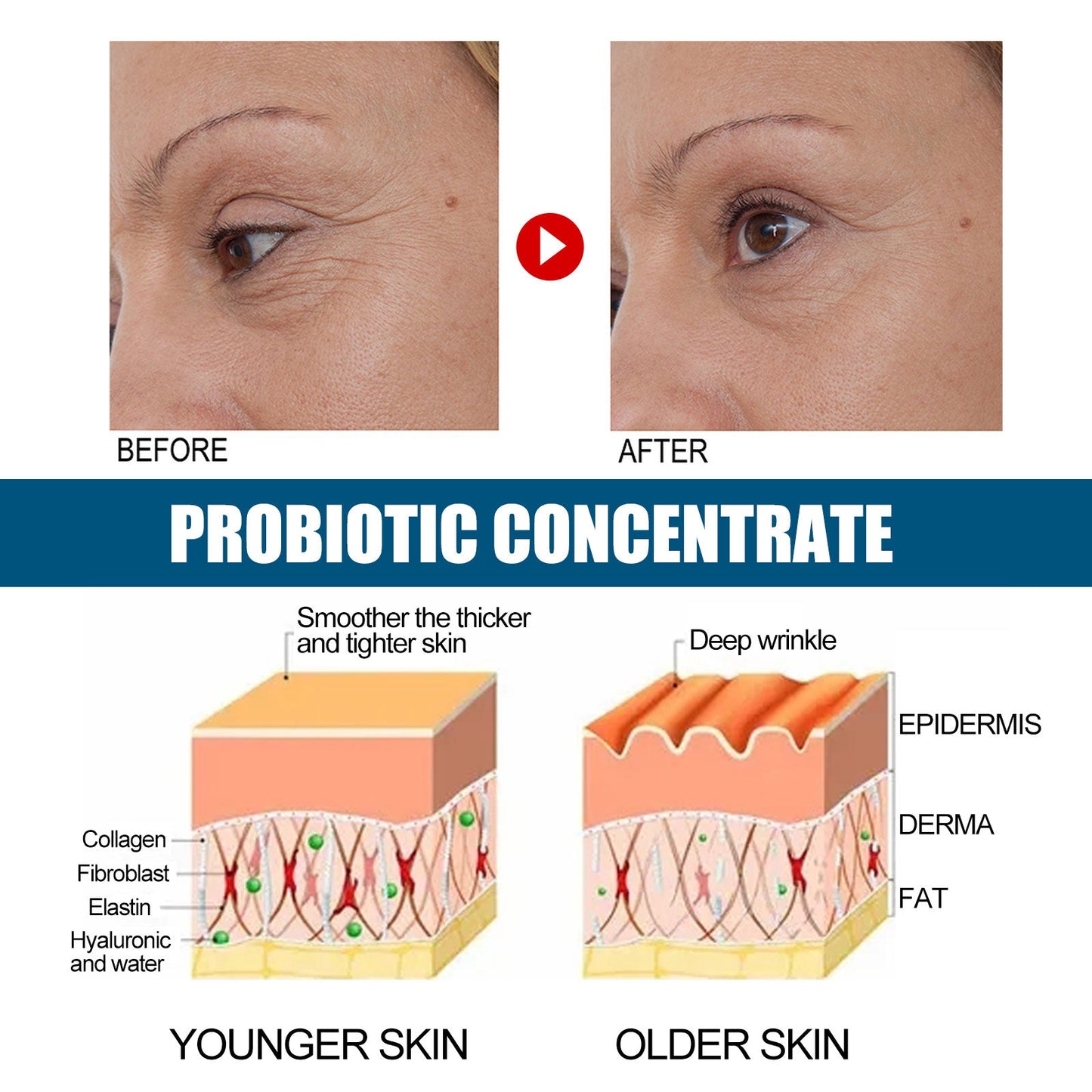 V89 Probiotic Serum Gently Nourishes Facial Skin Hydrating Skin Care Serum - Korvel