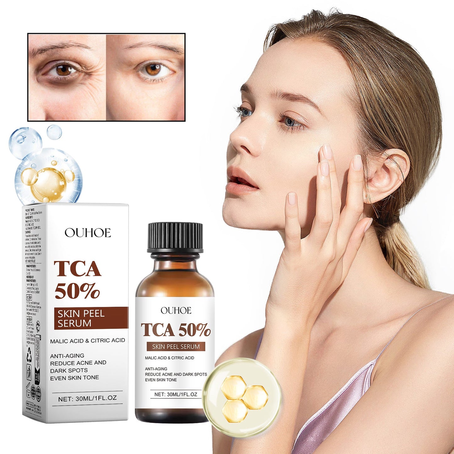 TCA 50 Skin Peel Serum, It Moisturizes Brightens The Firming Skin Fade Wrinkles This Skin Cream - Korvel