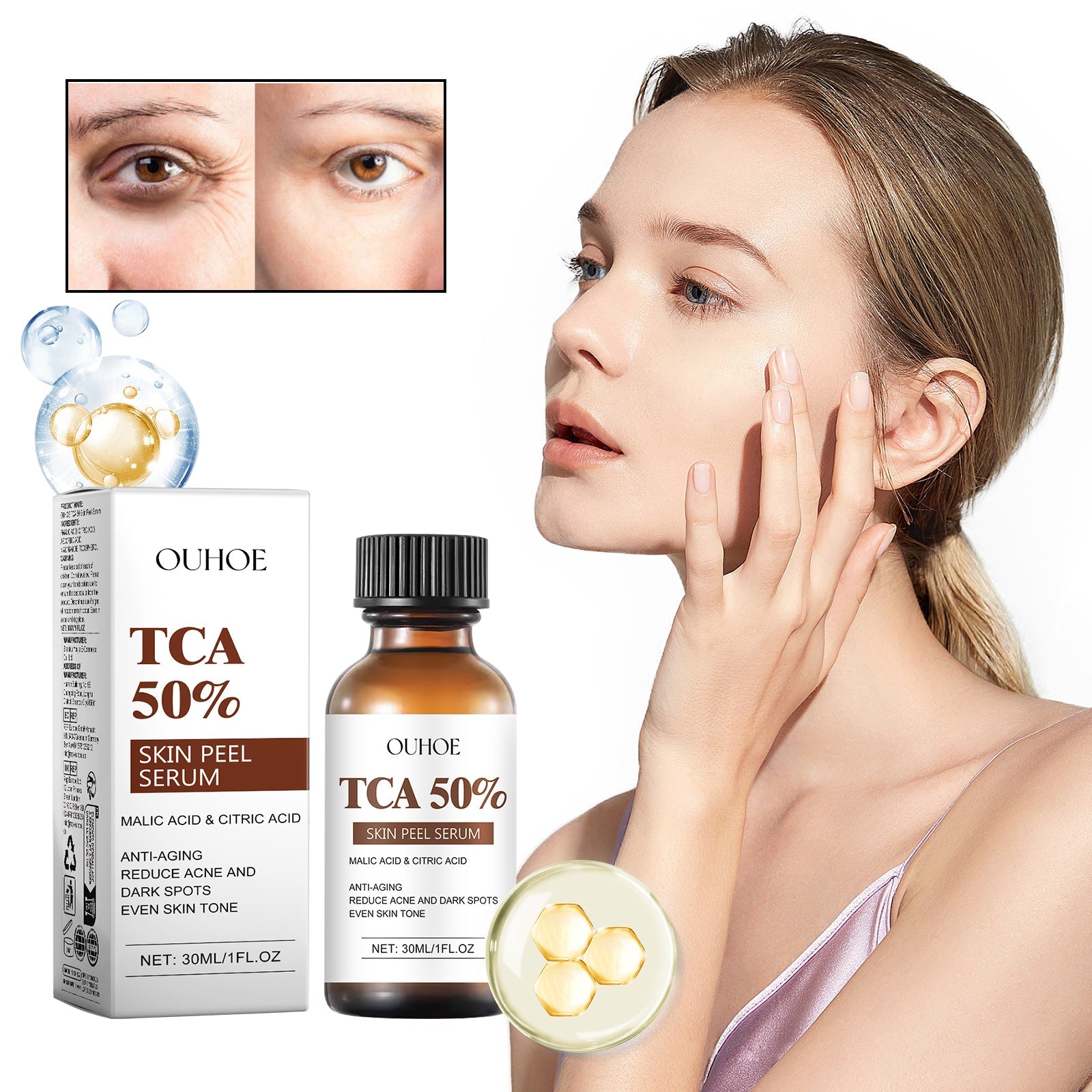 TCA 50 Skin Peel Serum, It Moisturizes Brightens The Firming Skin Fade Wrinkles This Skin Cream - Korvel