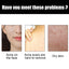 Shea Butter Black Soap, Repair Acne Pimple Acne Clear Pores Moisturize Smooth Skin Soap - Korvel