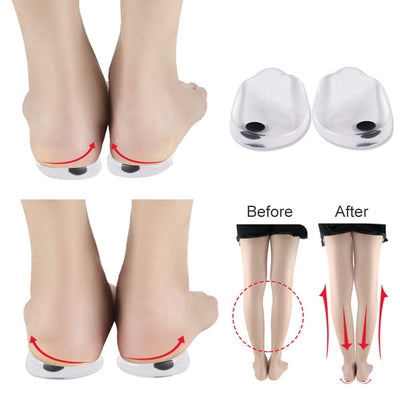 2PCS Insoles Correction Shoe Inserts Pads Effective O/X Type Leg Bowed Legs Knee Valgum Straightening for Women Men Health Care - Korvel