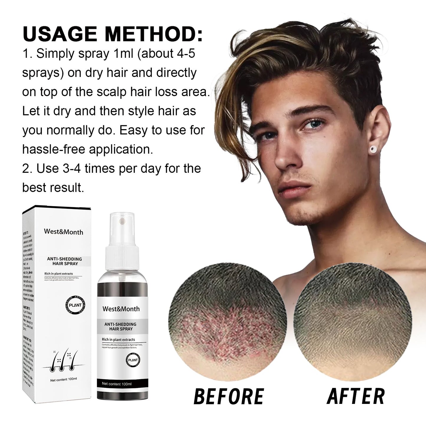 West & Month Anti-Shedding Hair Spray, Improve The Hairline Hair Hair Nutrition Moisture Hair Roots - Korvel