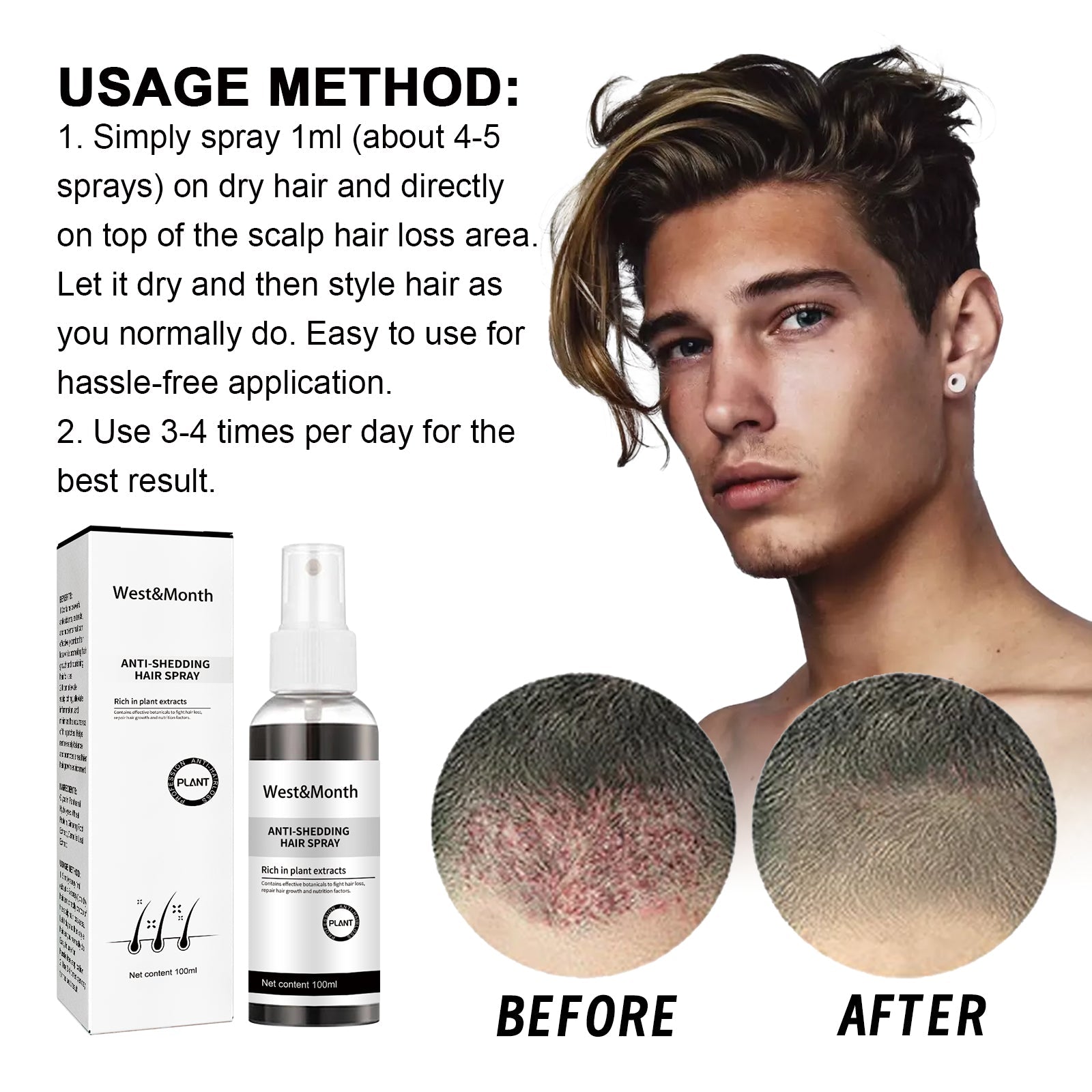 West & Month Anti-Shedding Hair Spray, Improve The Hairline Hair Hair Nutrition Moisture Hair Roots - Korvel