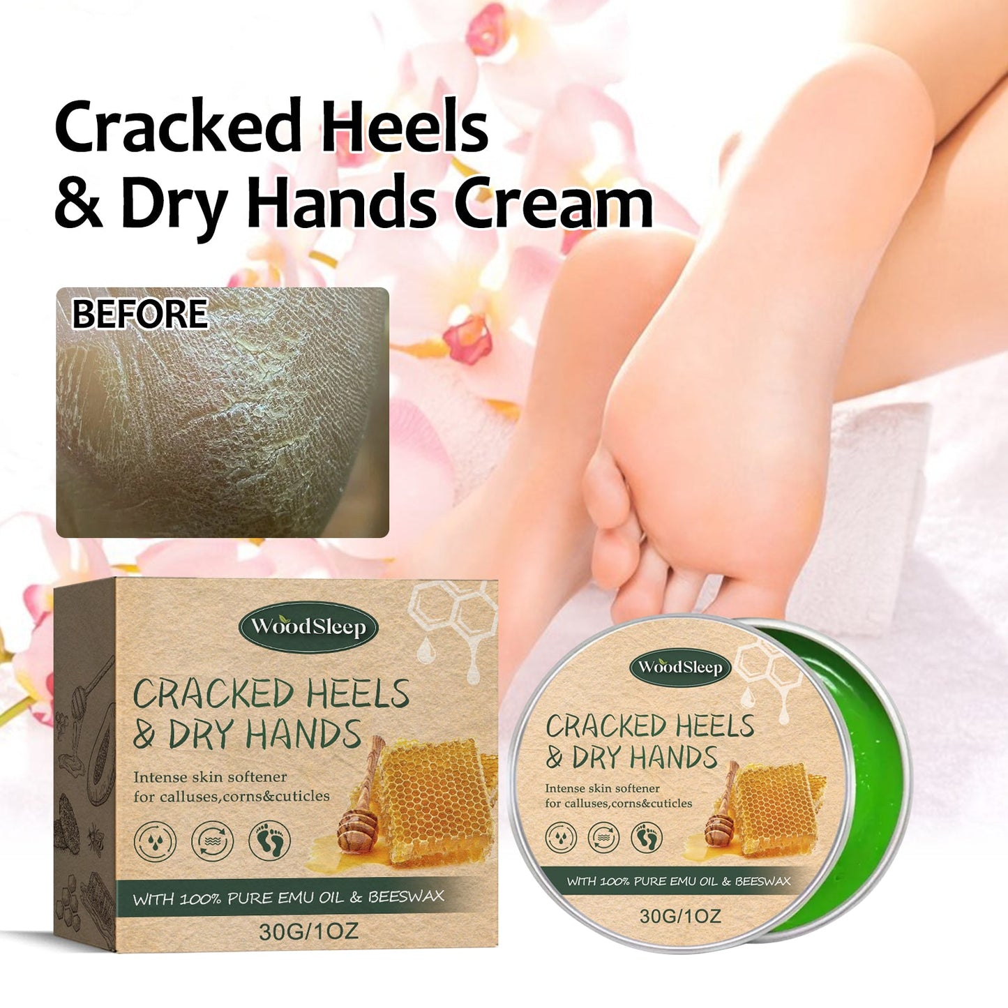 Anti-Crack Hand And Foot Care Cream Moisturizes Skin To Prevent Dry Cracking, Peeling, Freezing And Chapping - Korvel