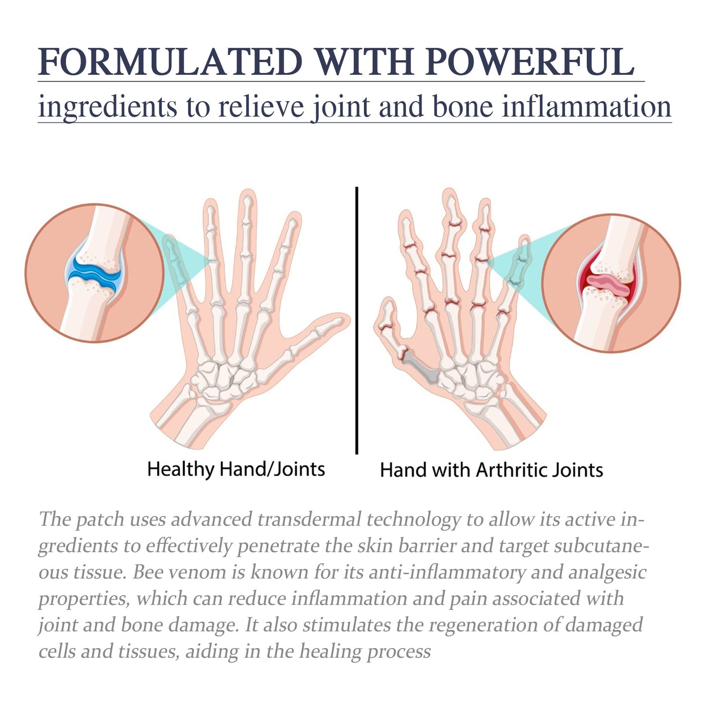 Bee Venom Joint Cream, Relieves Hands Legs Bones Knees Lumbar Spine Sedentary Joint Pain Body Care Cream - Korvel