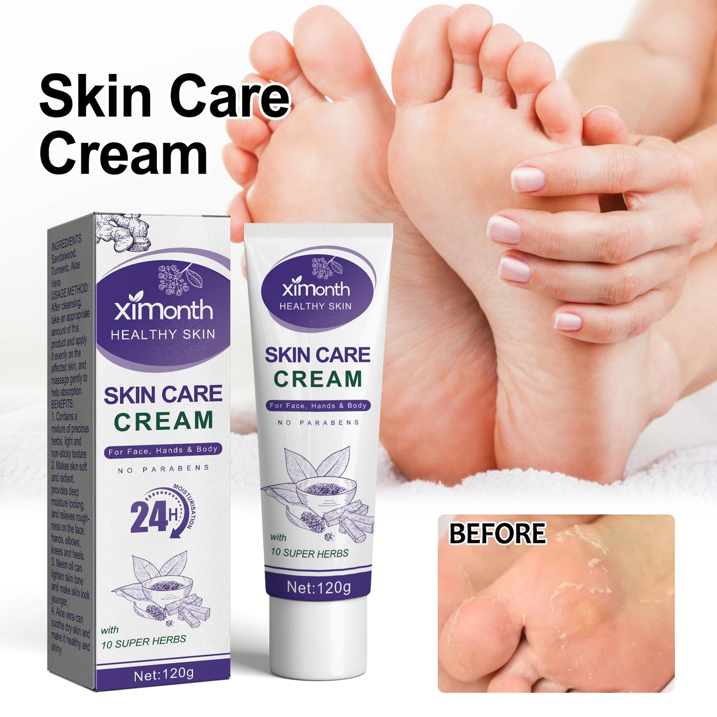 Skin Care Cream, Autumn And Winter Skin Anti-Crack Peeling Exfoliating Moisturizing Soft Moisturizing Body Cream - Korvel