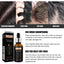 Hair Growth Essential Oil, Dense Hair Growth Repair Dry Hair And Moisture Hair Essence - Korvel