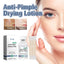 Anti-Pimple Drying Lotion, Facial Cleansing And Repair Lighten Acne Marks And Pits, Close Your Mouth And Mild Skin Cream - Korvel