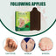 Bunion Relief Patch Thumb Valgus Bigfoot Bunion Valgus Double Toe Foot Care Patch - Korvel