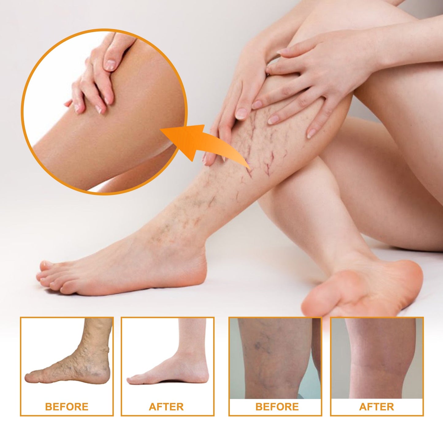 Vitamin K Cream Skin Care For Sore And Swollen Legs Earthworm Leg Vein Massage Cream - Korvel