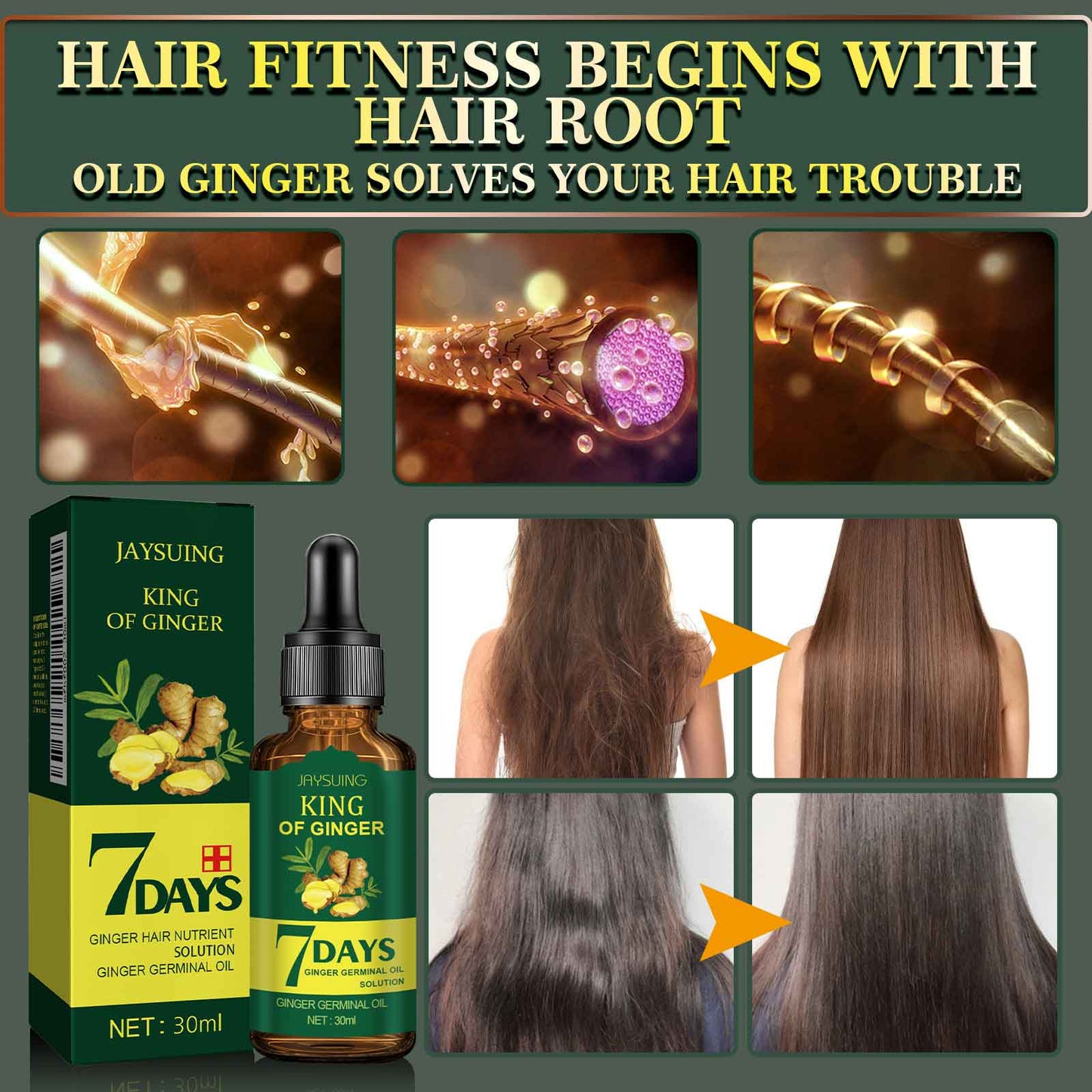 Ginger Hair Care Essential Oil Refreshing And Nourishing Scalp Follicles And Strengthening Hair Nutrition Solution - Korvel