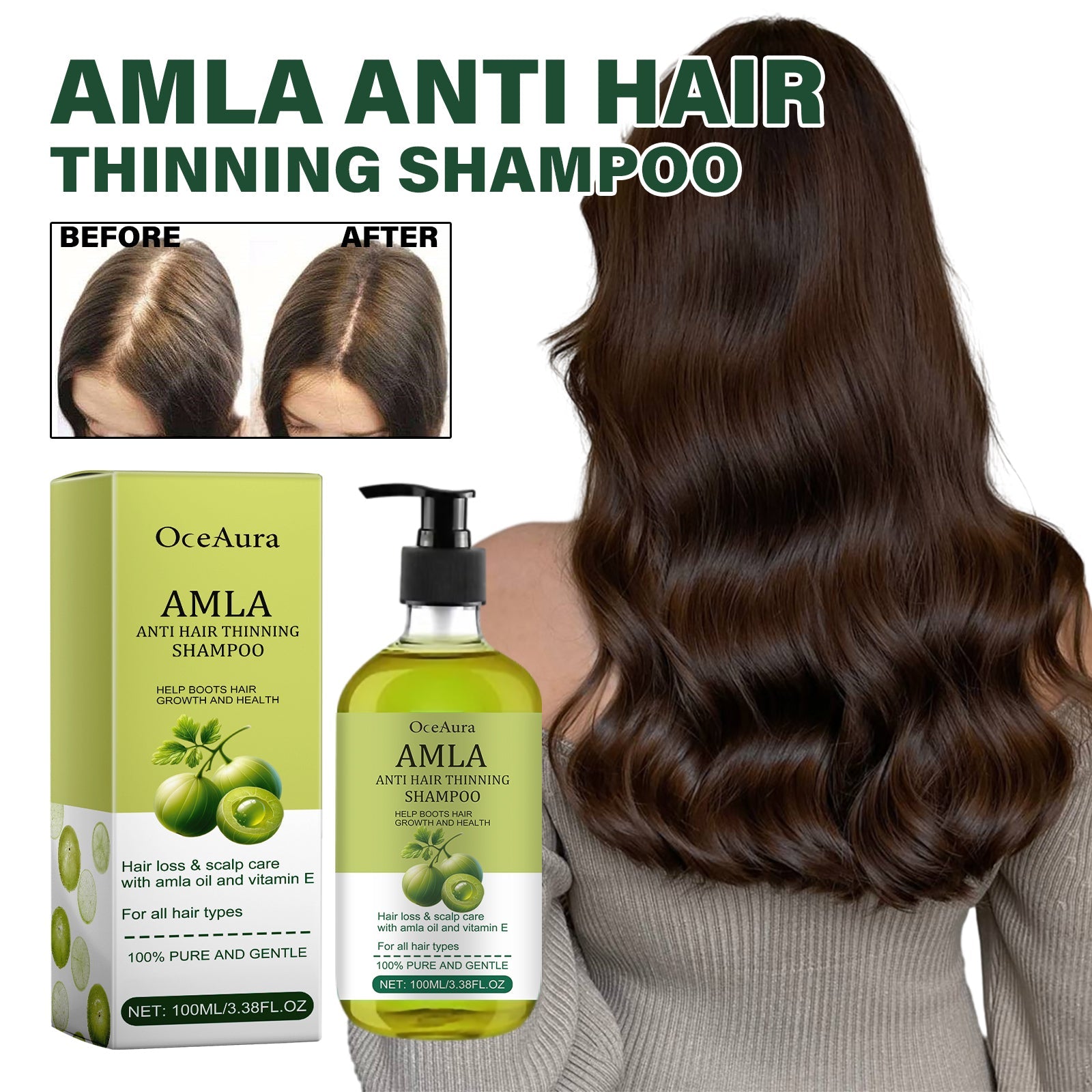 Amla Anti Hair Thinning Shampoo, Scalp Cleanness Moist Smooth Shiny Hair, Dense Hair Wash Protect Suits - Korvel