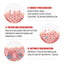 Skin Repair Cream Gentle Moisturizing Hydrating Moisturizing Repair Skin Care Repair Cream - Korvel