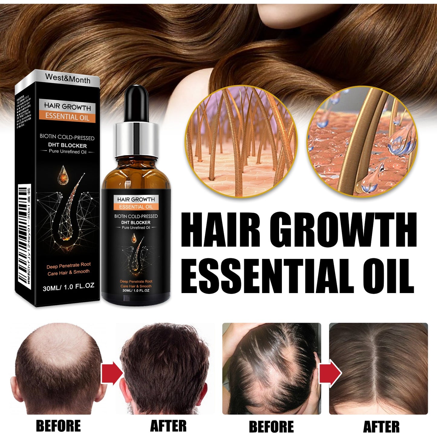 Hair Growth Essential Oil, Dense Hair Growth Repair Dry Hair And Moisture Hair Essence - Korvel