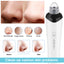 High-Definition Visual Blackhead Meter Three-Speed Intelligent Vacuum Adsorption Pore Cleaner Wifi Timing - Korvel