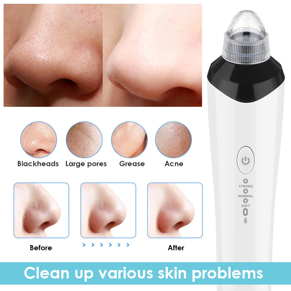 High-Definition Visual Blackhead Meter Three-Speed Intelligent Vacuum Adsorption Pore Cleaner Wifi Timing - Korvel