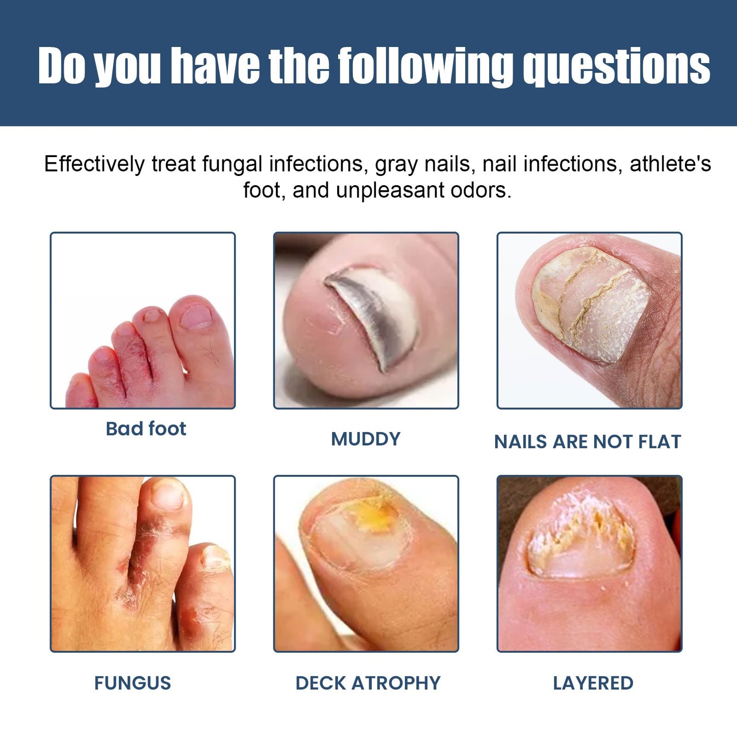 Moisturizing Nail Care Spray for Brightening Foot Nails