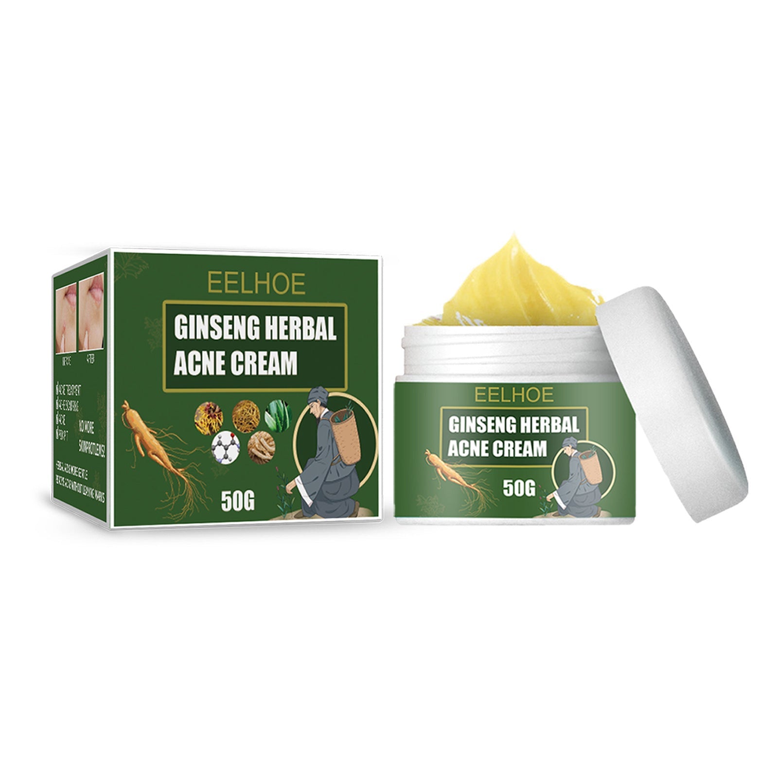 Herbal Acne-Removing Cream Anti-acne-Removing Cream Moisturizing Cleansing Cream Water Oil Balance Anti-acne-Removing Cream - Korvel