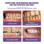 Teeth Cleaning Powder, Fresh Breath Tartar Stone White Teeth Cleaning Powder Oral Care - Korvel