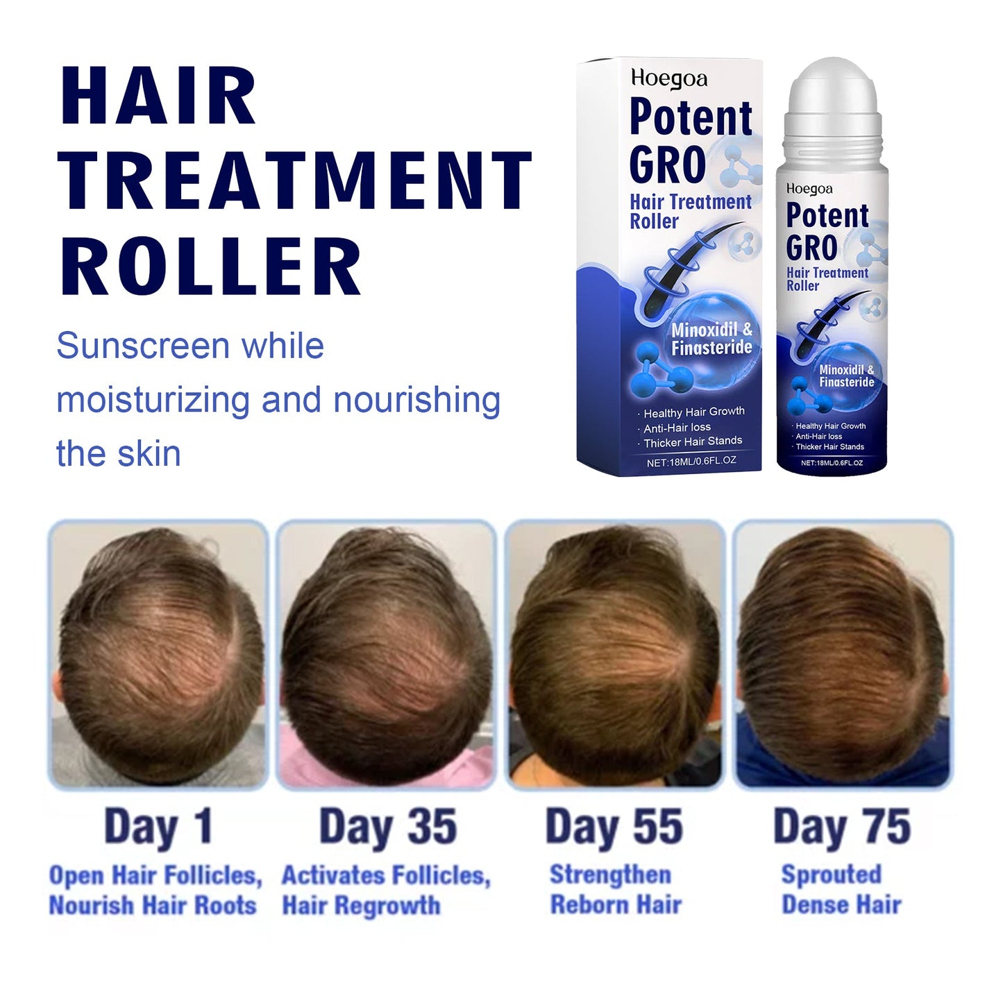 HOEGOA Hair Treatment Roller for Stronger, Thicker Hair