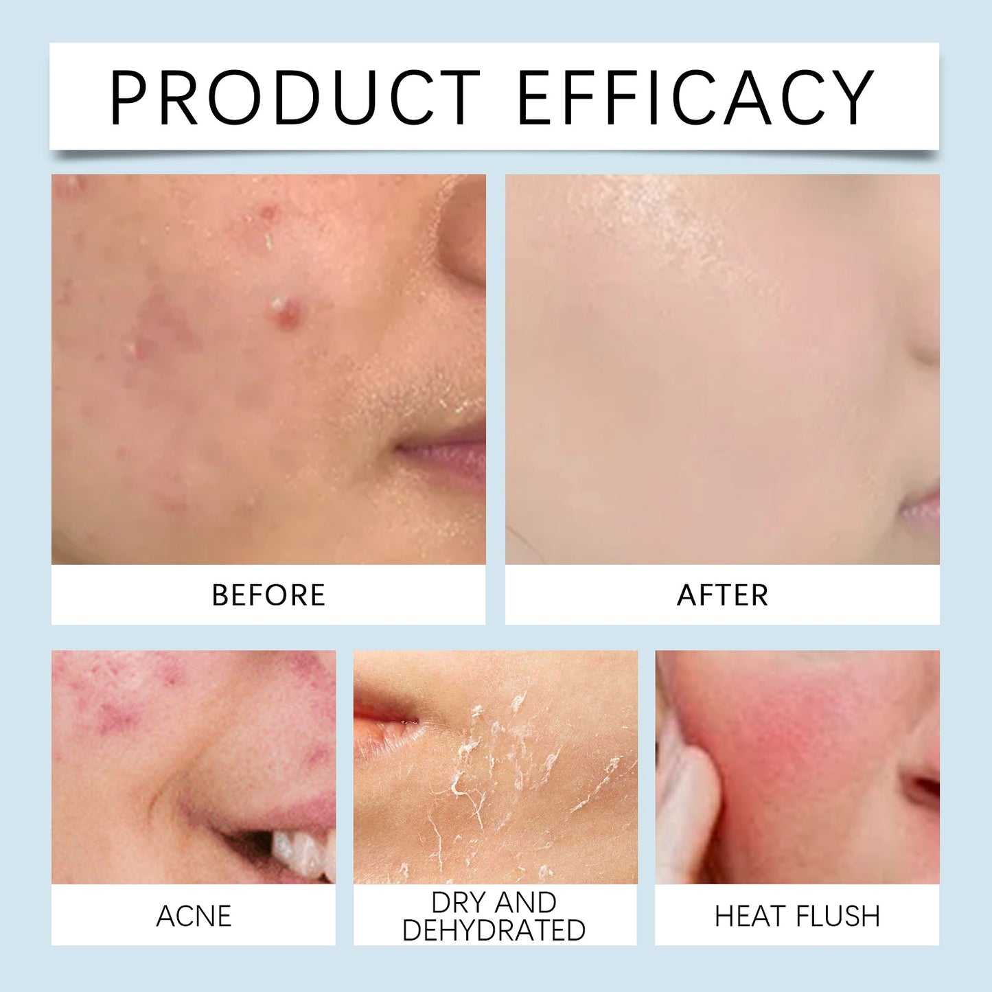 Hyaluronic Acid Face Serum, Radiant Facial Skin Improves Skin Pores And Hydrates - Korvel
