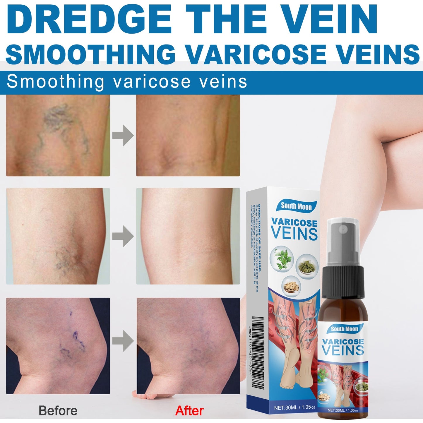 Leg Care Spray Gently Relieve Leg Discomfort, Blue Veins And Bumps Repair Daily Care - Korvel