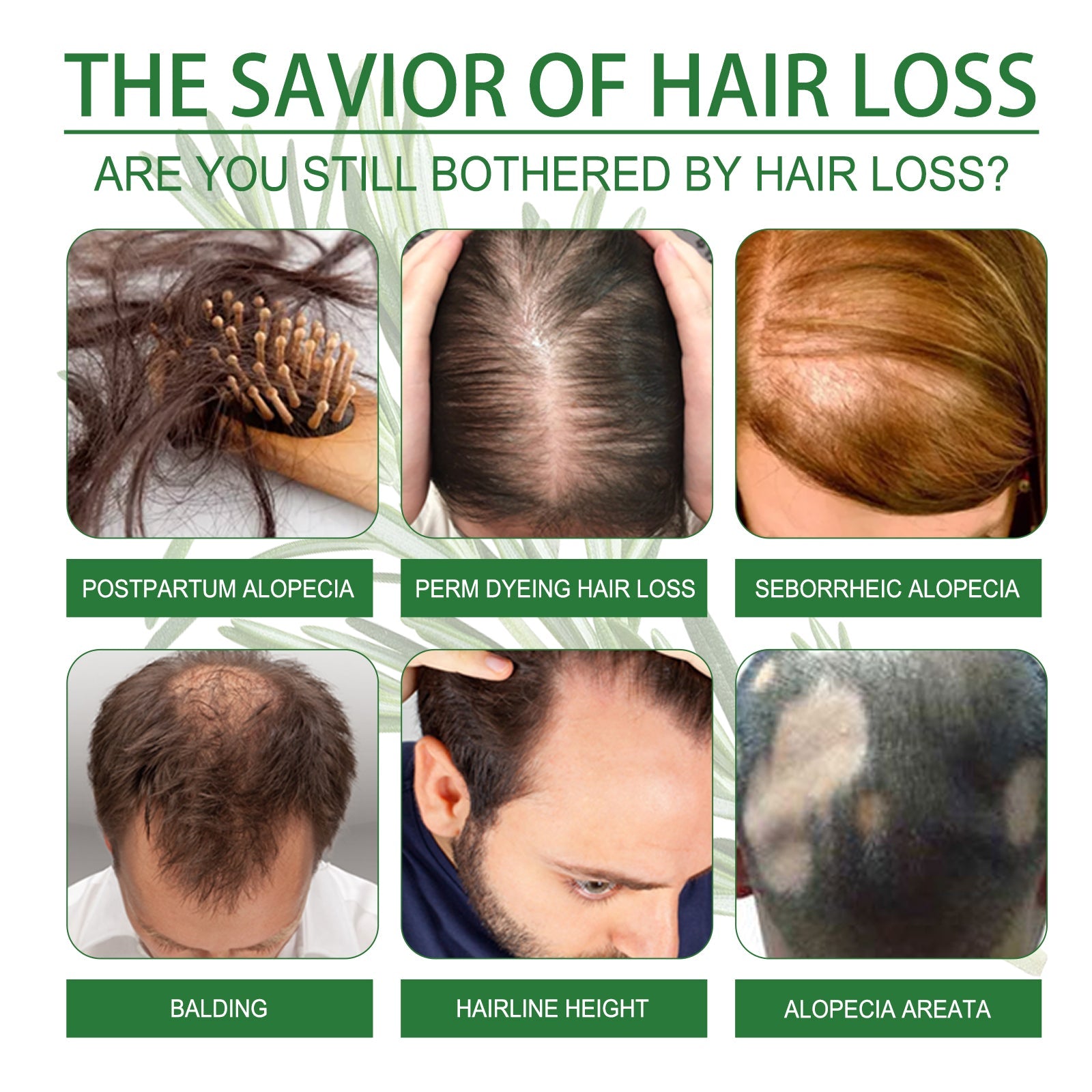 Rosemary Water, Moisturize Hair Roots Repair Damaged Hair Strengthen Hair And Prevent Hair Loss - Korvel